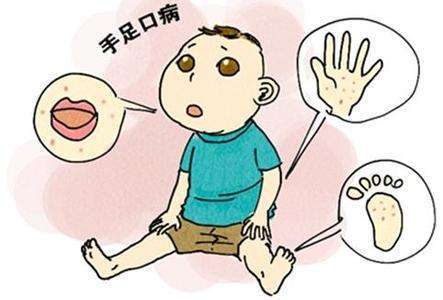 春意盎然，勿忘防治手足口